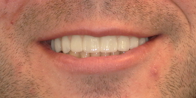 Image for 