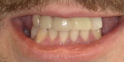 Image for 