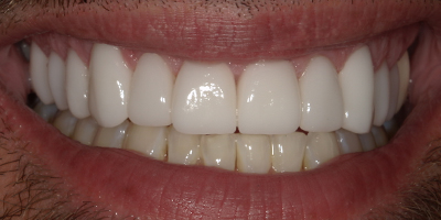 Image for 