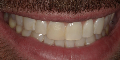 Image for 