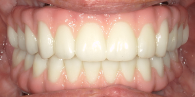 Image for 