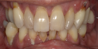 Image for 