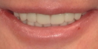 Image for 