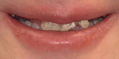 Image for 