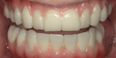 Image for 