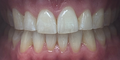 Image for 