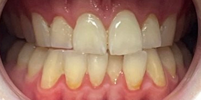 Image for 