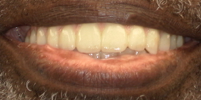Image for