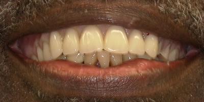 Image for