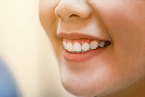Unveil Your Best Smile With Gummy Smile Treatment in Oakhurst