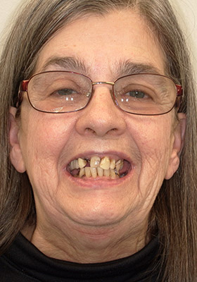 smile-before-full-01