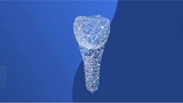 the-future-of-dental-implants