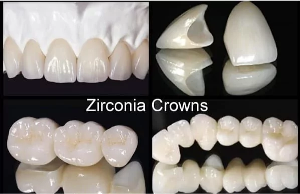 zirconia-crowns-blog