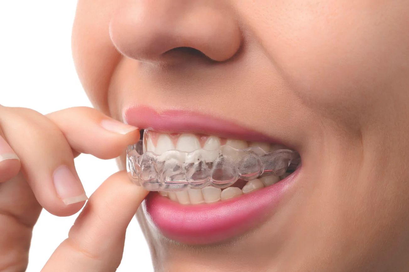 how-invisalign-works